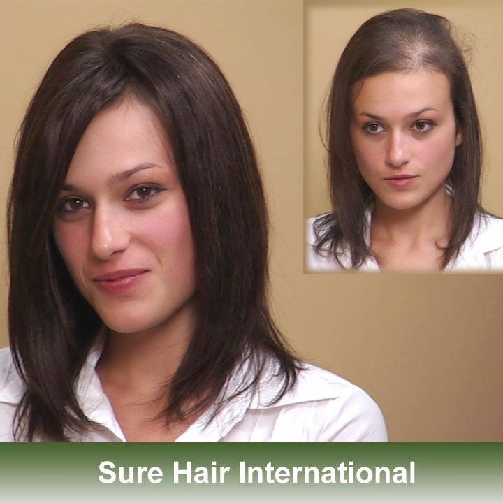 Sure Hair International | 43 Keefer Ct Unit #200, Hamilton, ON L8E 4V4, Canada | Phone: (905) 560-7500