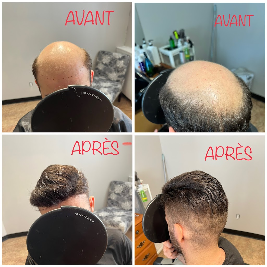 Prothèses et remplacement capillaires- Devine Studio | 233 Bd Sainte-Rose, Laval, QC H7L 1L7, Canada | Phone: (438) 998-6300