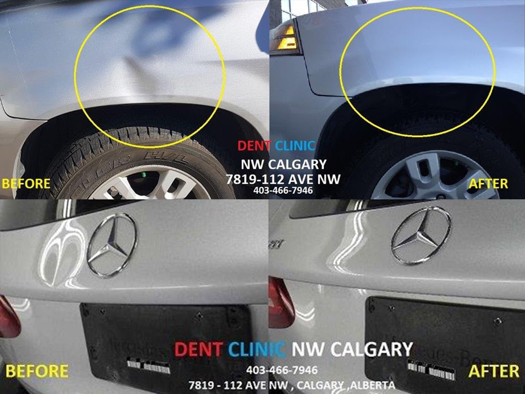 Dent Clinic | 7819 112 Ave NW, Calgary, AB T3R 1R8, Canada | Phone: (403) 466-7946