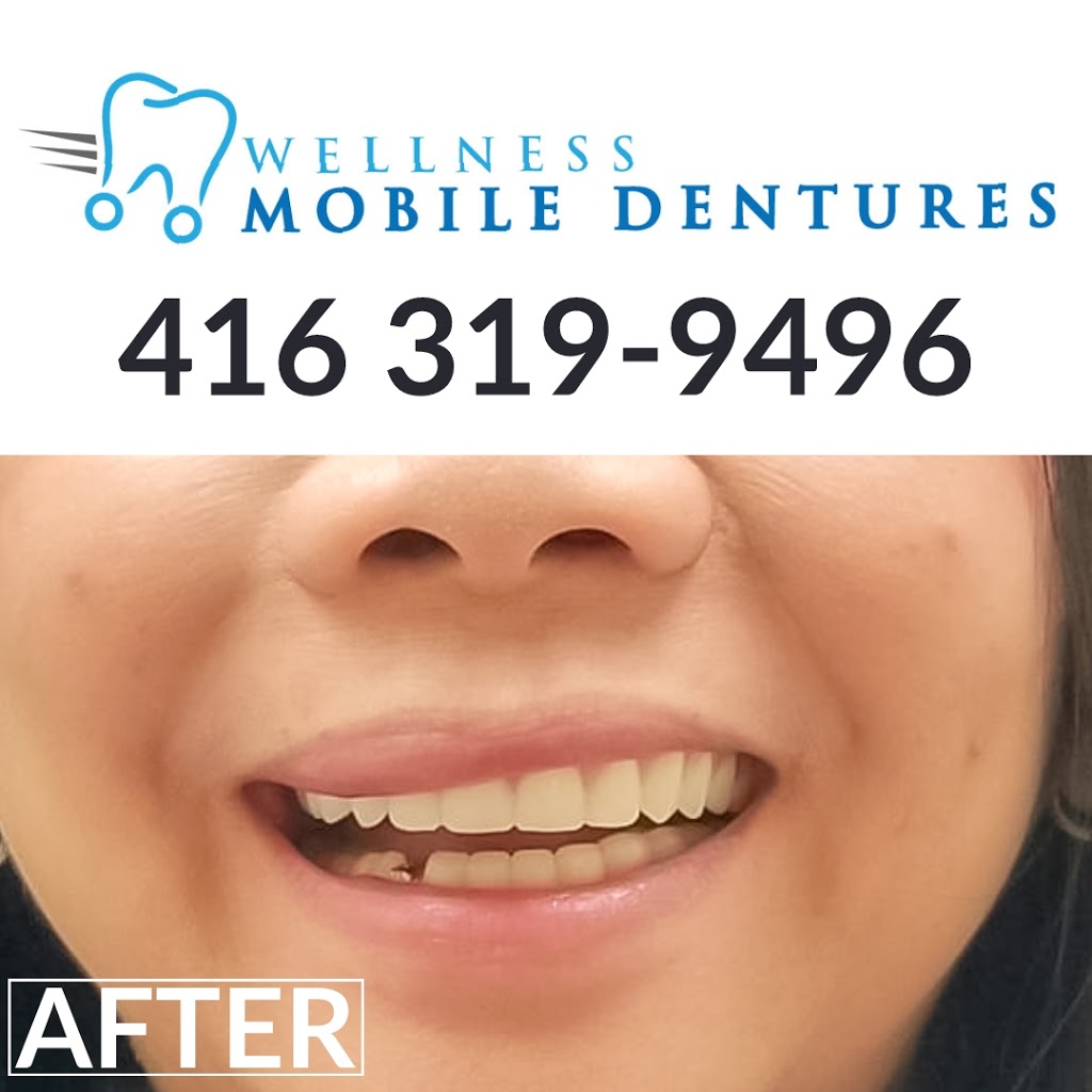 Wellness Mobile Dentures | Queensway W, Mississauga, ON L5B 2P7, Canada | Phone: (416) 319-9496