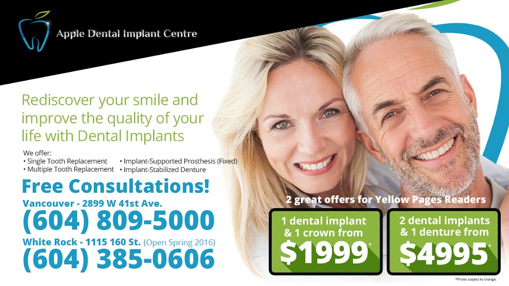 Apple Dental Implant Centre - Kerrisdale | 2899 W 41st Ave, Vancouver, BC V6N 3C5, Canada | Phone: (604) 809-5000