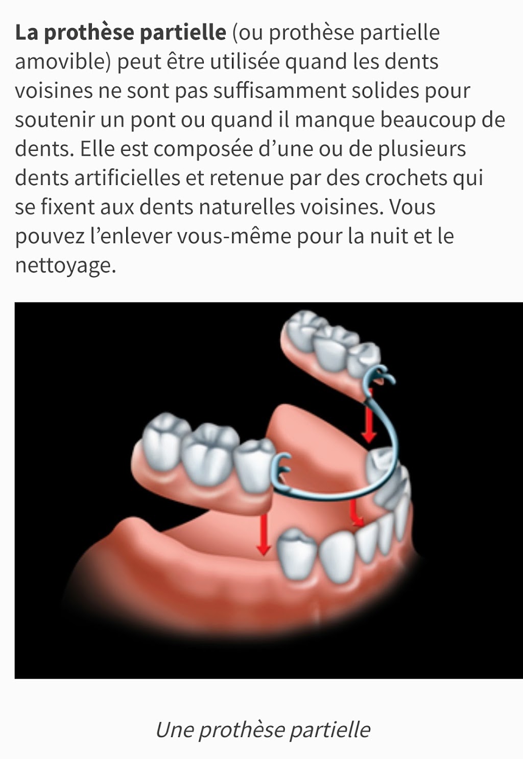 Clinique De Denturologie drummond | 458 Rue Lindsay, Drummondville, QC J2B 5L5, Canada | Phone: (819) 477-2447