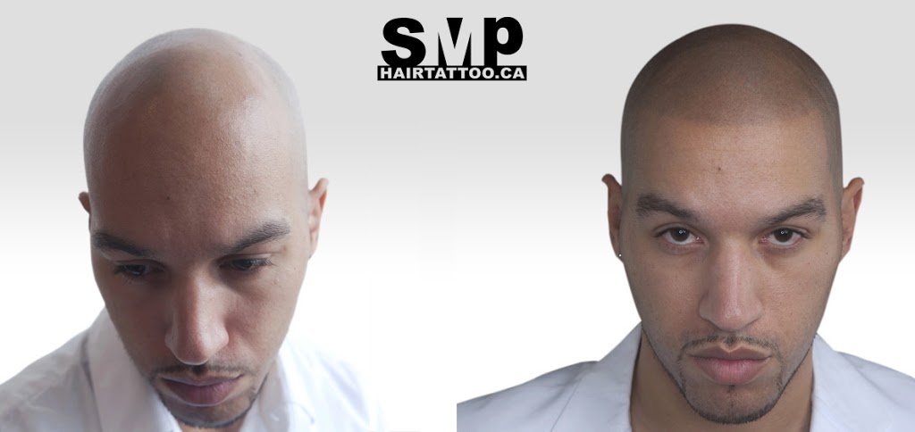 SMP® Scalp Micropigmentation Richmond Hill | HAIRTATTOO.CA | 9140 Leslie St #301, Richmond Hill, ON L4B 3L6, Canada | Phone: (647) 492-9093