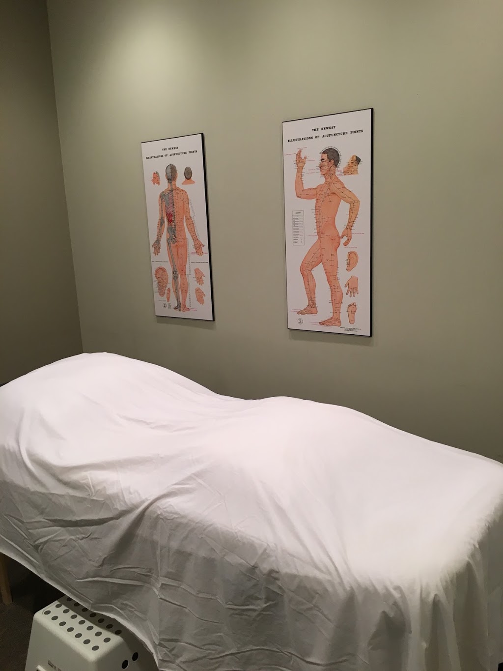 Peterborough West Acupuncture Clinic | 1542 Ireland Dr, Peterborough, ON K9K 2T2, Canada | Phone: (705) 768-2445