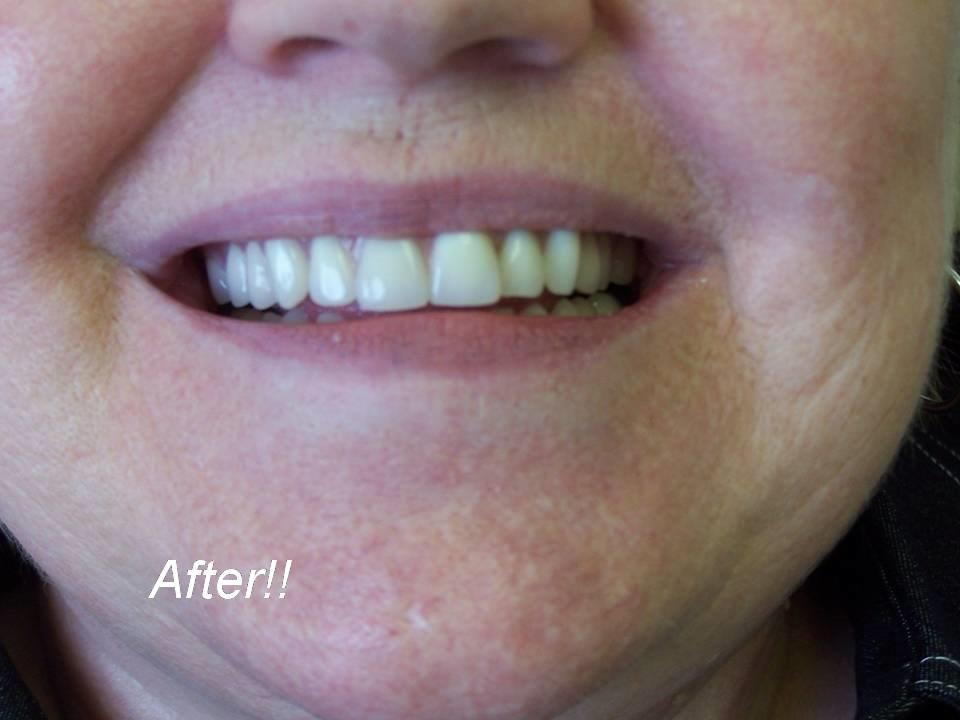 Central Park Denture Clinic | 1711 Cook St, Victoria, BC V8T 3P2, Canada | Phone: (250) 388-4100