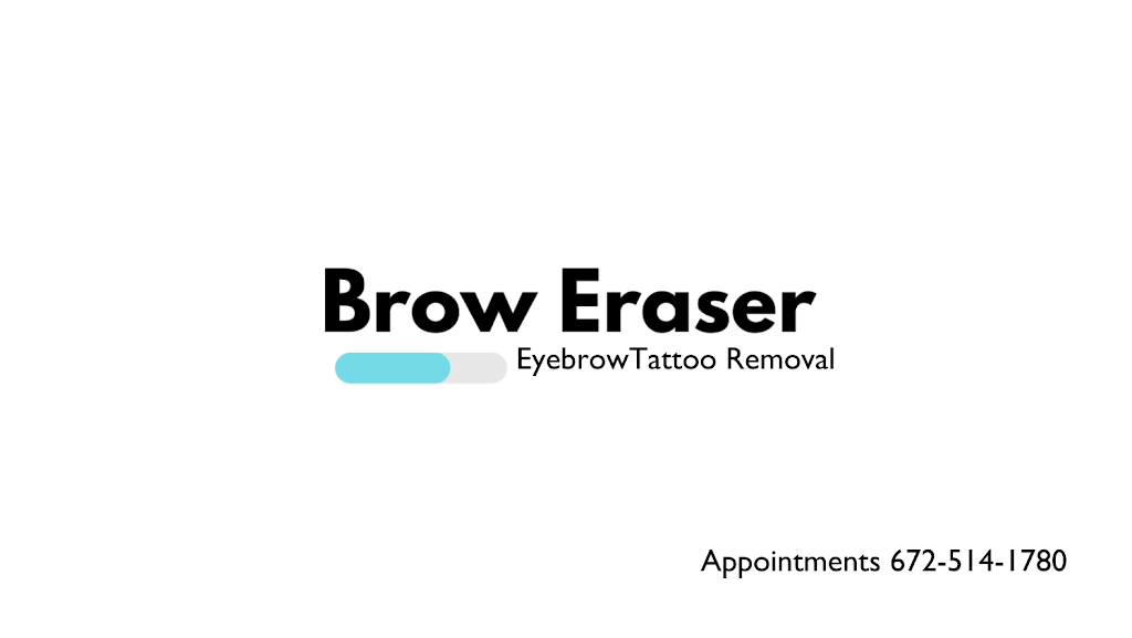 Emergency Removal - Eyebrow Tattoo Removal | 11675 Seventh Ave, Richmond, BC V7E 4X4, Canada | Phone: (672) 514-1790