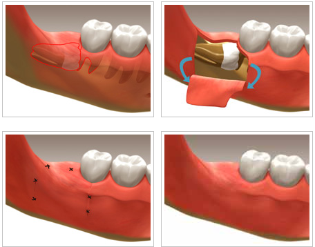 New Minas Dental Centre | 9198 Commercial St, New Minas, NS B4N 3E5, Canada | Phone: (902) 681-3368