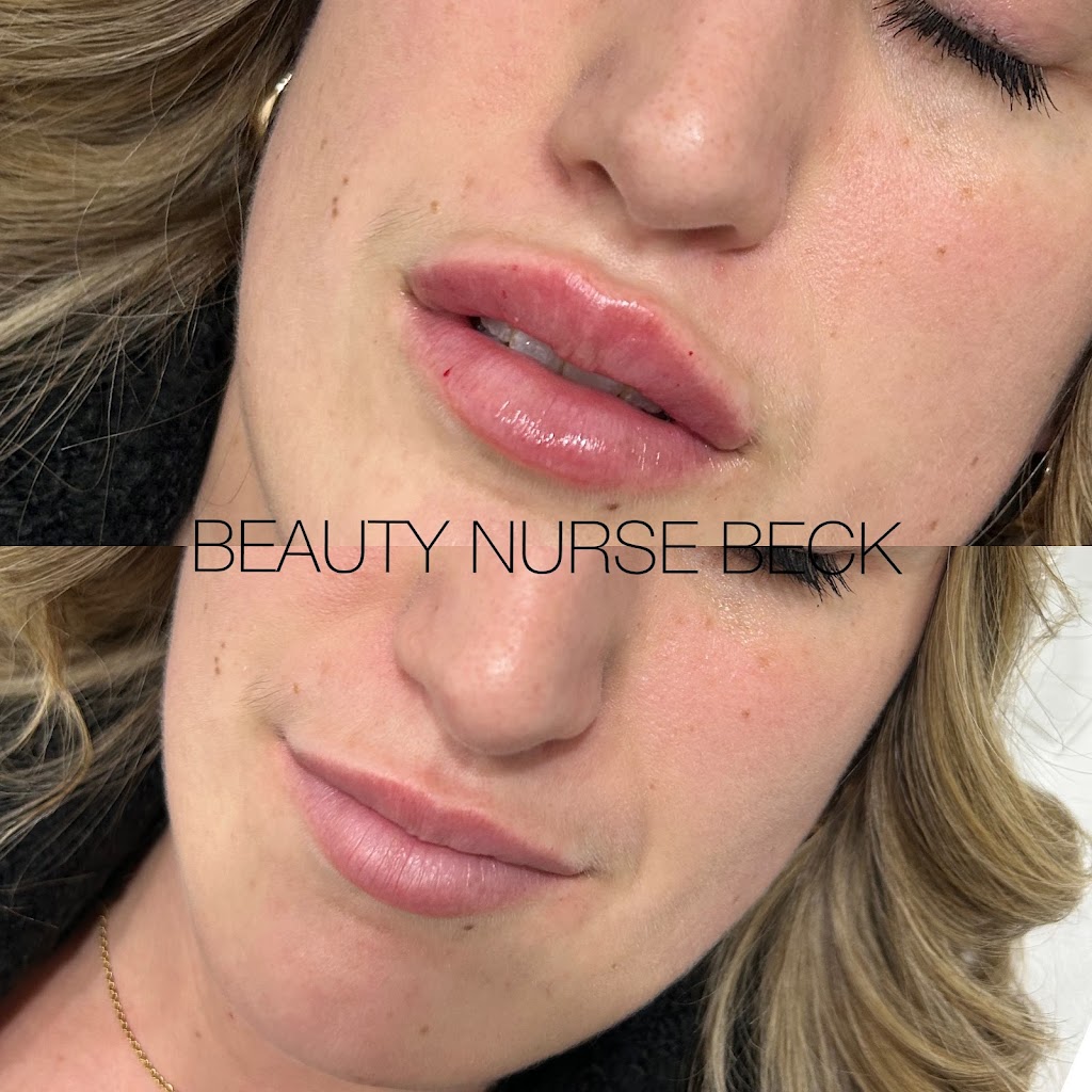 Beauty Nurse Beck - Seaforth | 39 Main St S, Seaforth, ON N0K 1W0, Canada | Phone: (226) 338-9202