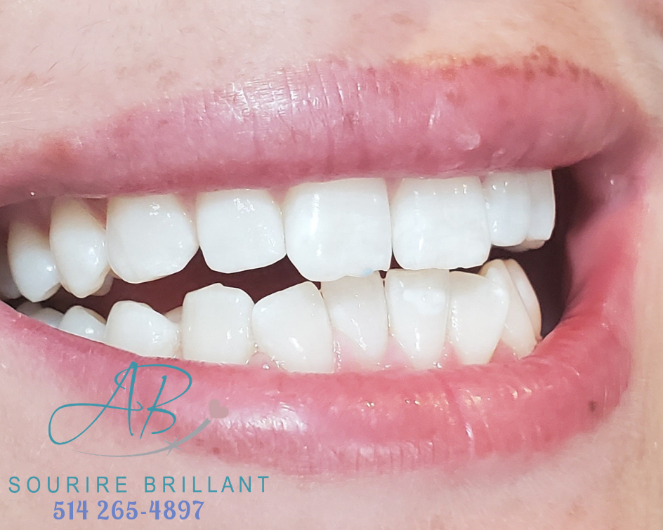 A.B. Sourire Brillant | 4600 Boulevard Sainte-Rose, Laval, QC H7R 1Z2, Canada | Phone: (514) 265-4897