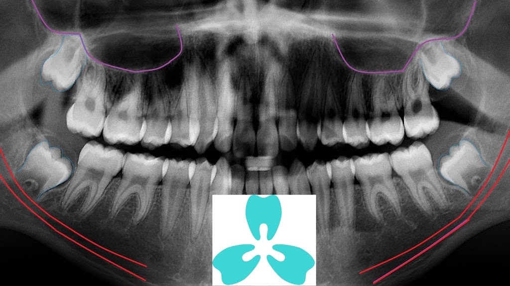 PleasantView Family Dental - Dr. Ross Tam Dr. Michael Chan Dr. C | 2772 Victoria Park Ave Suite 201, North York, ON M2J 4A8, Canada | Phone: (416) 491-6262