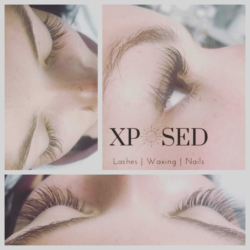 Xposed Esthetics | 529 Baycroft Dr, Martensville, SK S0K 2T2, Canada | Phone: (306) 203-4643