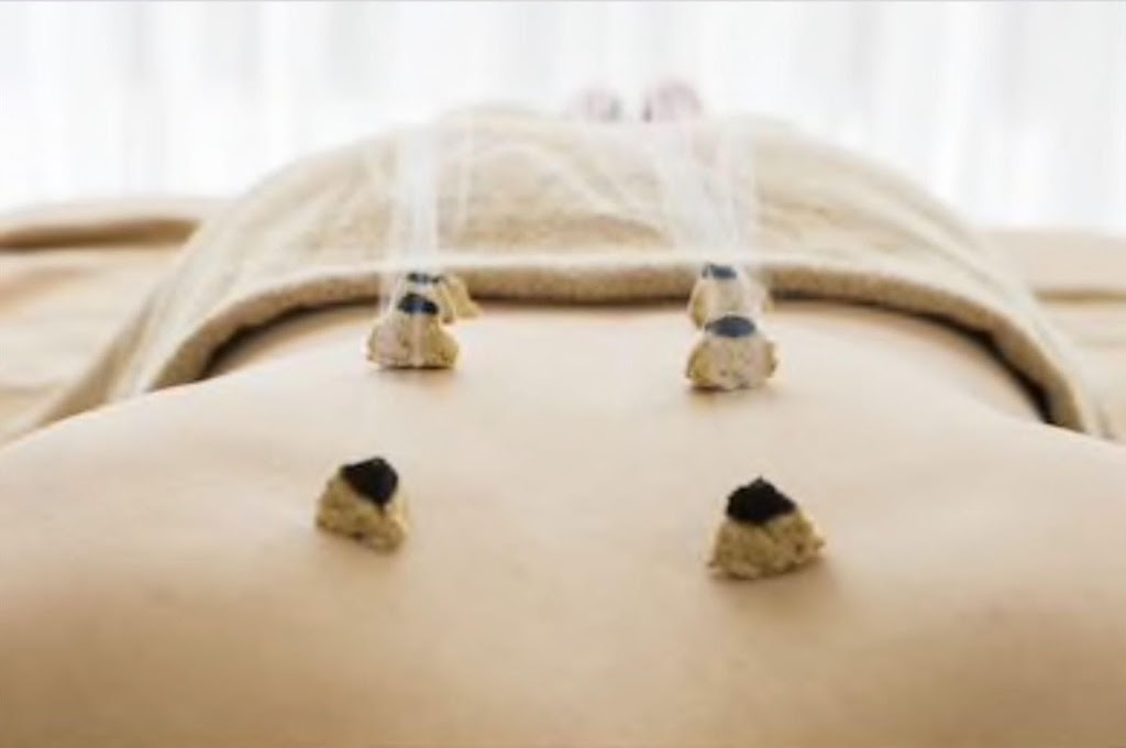 Bobs Rehab in Kanata, Ottawa - Acupuncture - Chinese Tui Na Mas | 767 Silver Seven Rd Unit 27, Kanata, ON K2V 0H1, Canada | Phone: (613) 800-4677