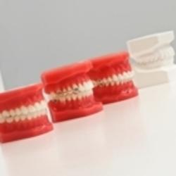 Clinique Orthodontique Venne | 296 Bd Iberville, Repentigny, QC J6A 2A5, Canada | Phone: (450) 581-7878