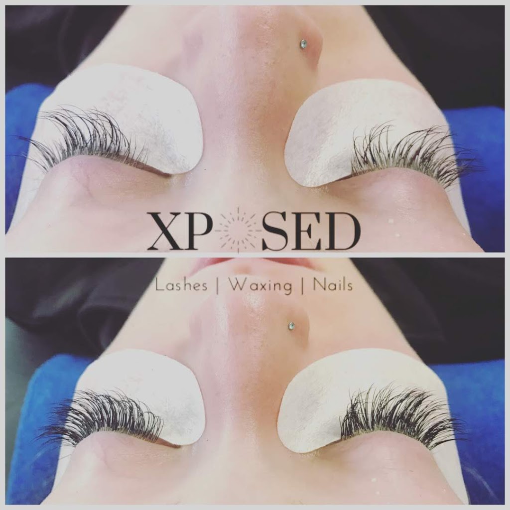 Xposed Esthetics | 529 Baycroft Dr, Martensville, SK S0K 2T2, Canada | Phone: (306) 203-4643