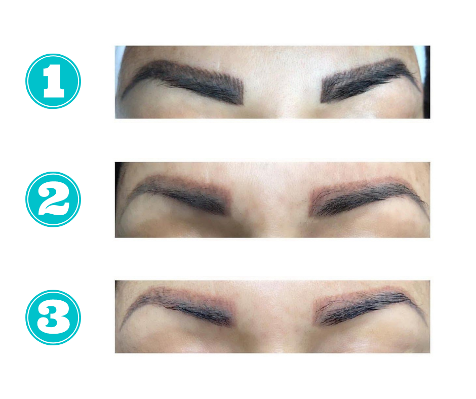 Emergency Removal - Eyebrow Tattoo Removal | 11675 Seventh Ave, Richmond, BC V7E 4X4, Canada | Phone: (672) 514-1790