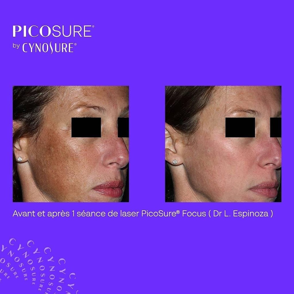 Dermal Essence | 44 Terr. Bellerive, Lavaltrie, QC J5T 1A6, Canada | Phone: (819) 470-8094