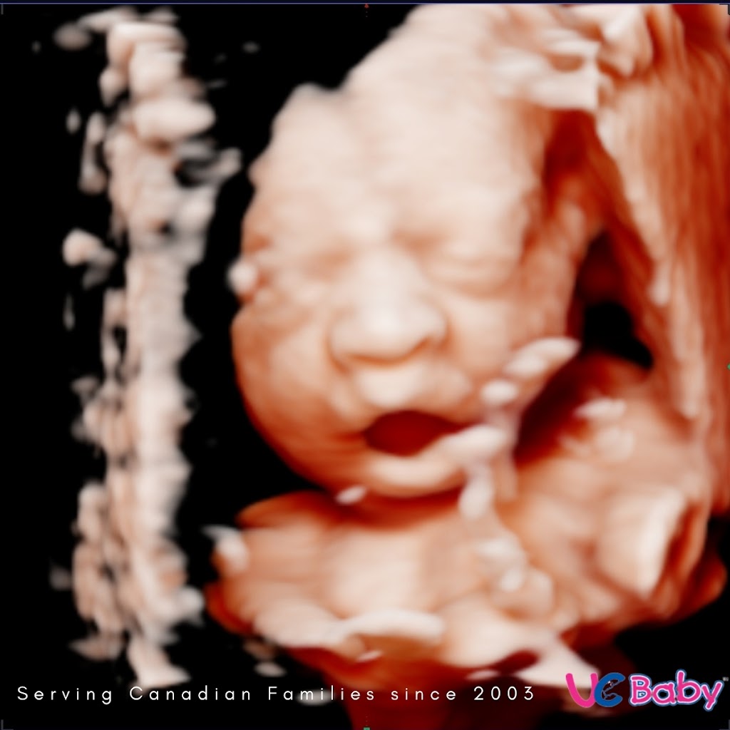 UC Baby 3D Ultrasound | 536 Laura Ave, Suite 203 Liberty Park Professional Center, Red Deer, AB T4E 0A5, Canada | Phone: (877) 682-2229