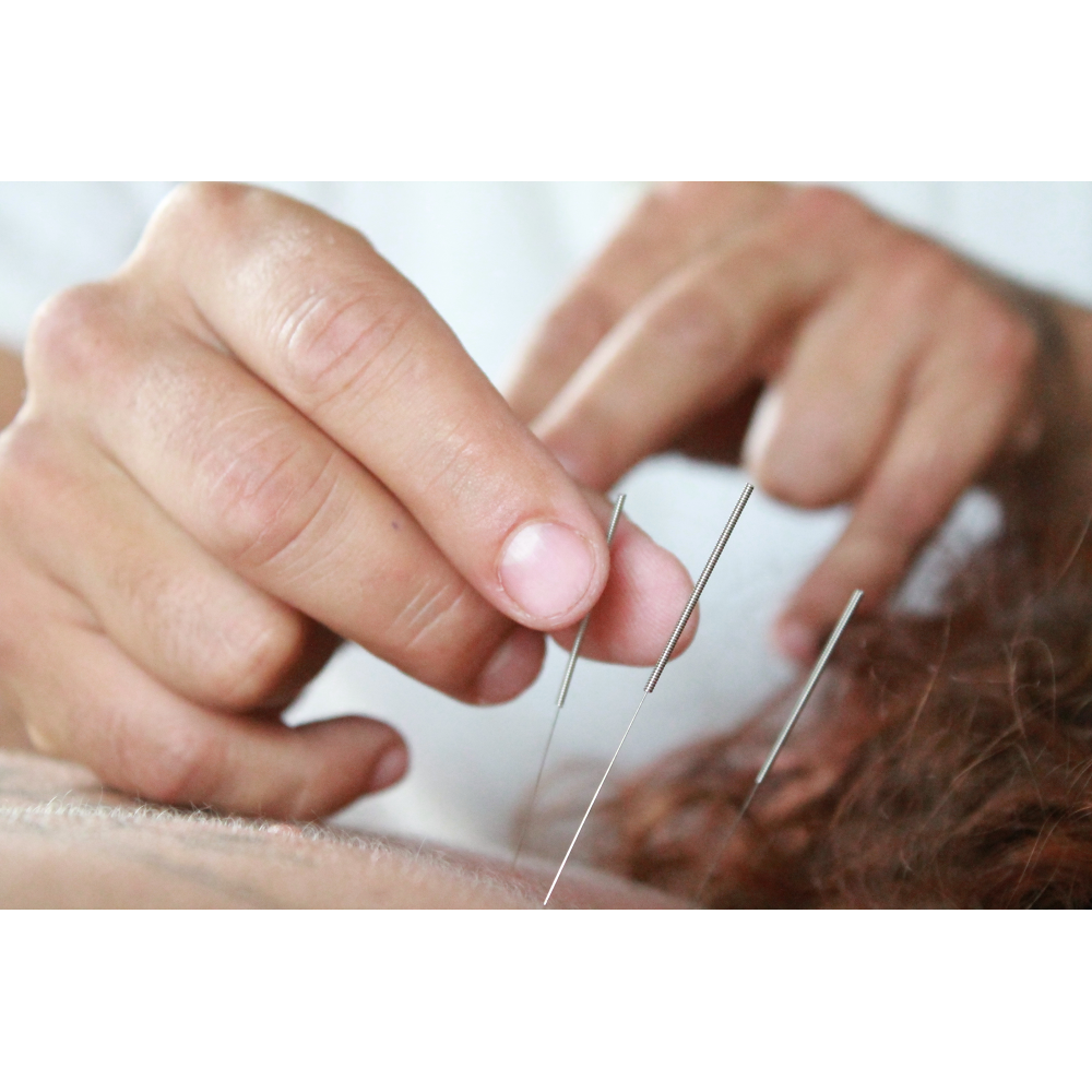 Acupuncture entre Ciel Et Terre | 695 Avenue de la Station #201, Shawinigan, QC G9N 1V9, Canada | Phone: (819) 244-4729