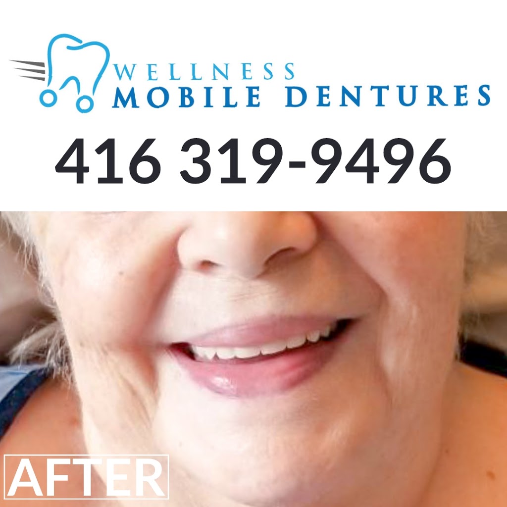 Wellness Mobile Dentures | 200 Queens Plate Dr, Etobicoke, ON M9W 6Y9, Canada | Phone: (416) 319-9496