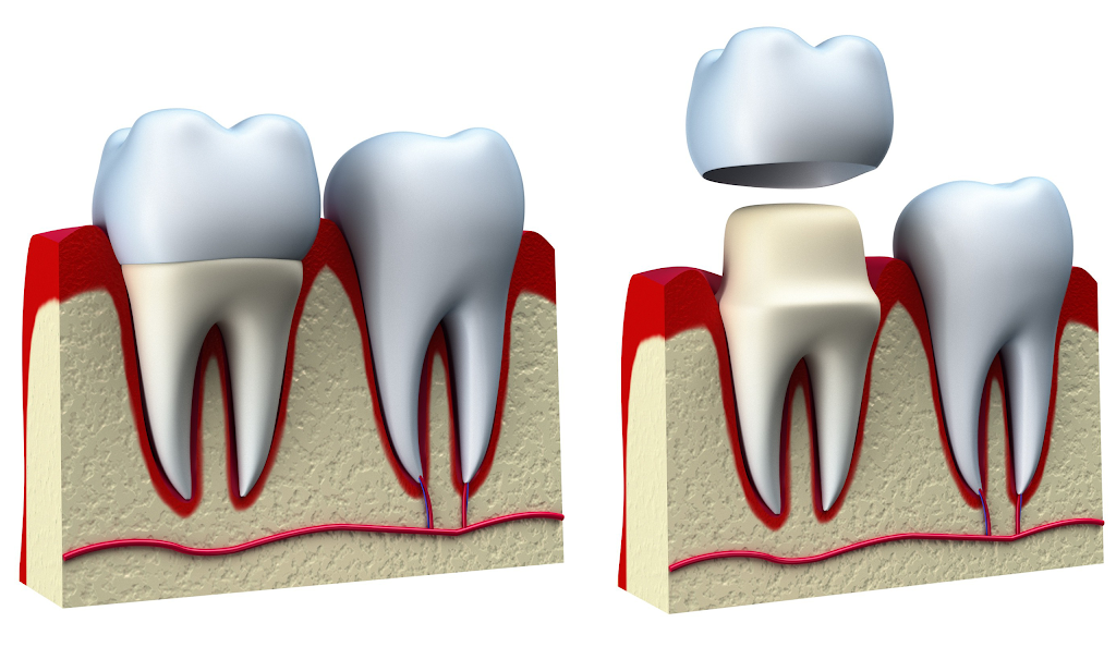 Rockwest Dental Clinic Mississauga | 4120 Dixie Rd #9, Mississauga, ON L4W 4V8, Canada | Phone: (905) 624-8681