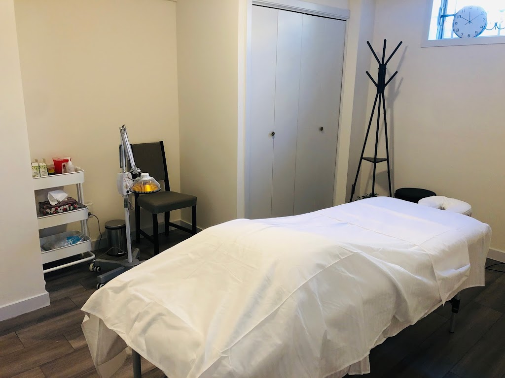 Classic acupuncture | 16 Edgeridge Way NW, Calgary, AB T3A 4G8, Canada | Phone: (647) 861-0238