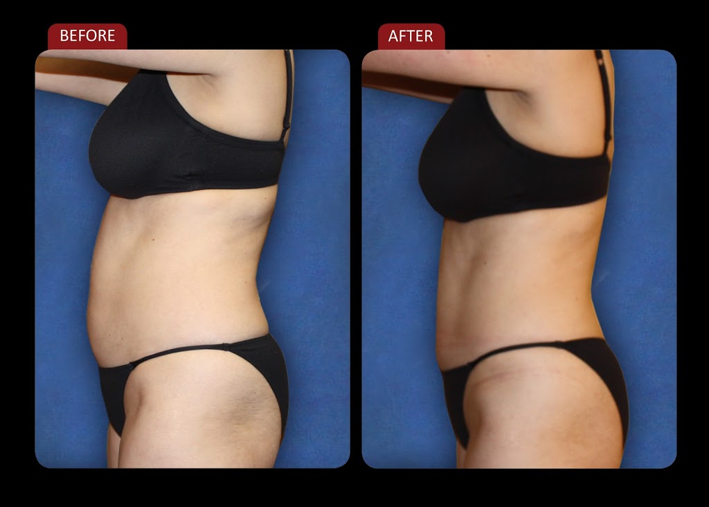 Global Laser Body Contouring | 208-269 Boul Saint-Jean, Pointe-Claire, QC H9R 3J1, Canada | Phone: (514) 619-2575