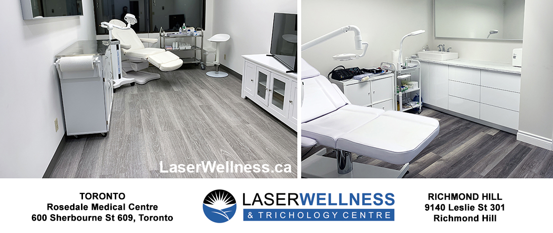 Laser Wellness & Trichology Centre | 9140 Leslie St #301, Richmond Hill, ON L4B 3L6, Canada | Phone: (647) 697-6450