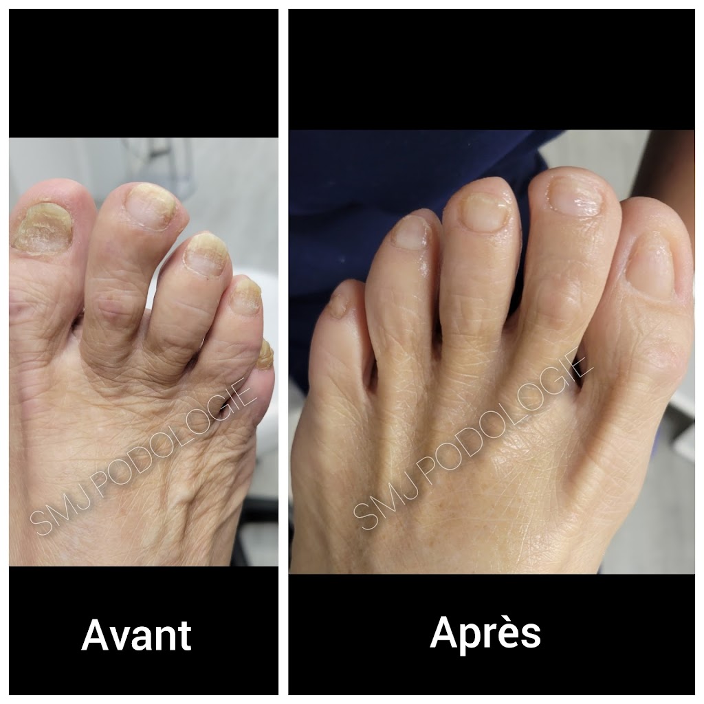 SMJ PODOLOGIE Soins de pieds à domicile | 359A Rang de la Rivière Sud-Ouest, Maskinongé, QC J0K 1N0, Canada | Phone: (514) 318-2050