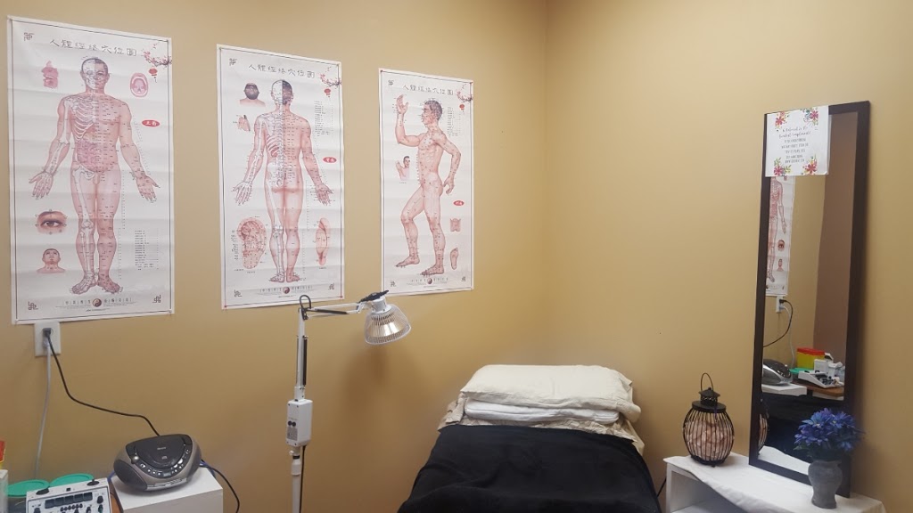 StoonRMT - Acupuncture | 606 22 St W #3, Saskatoon, SK S7M 5W2, Canada | Phone: (306) 954-1588