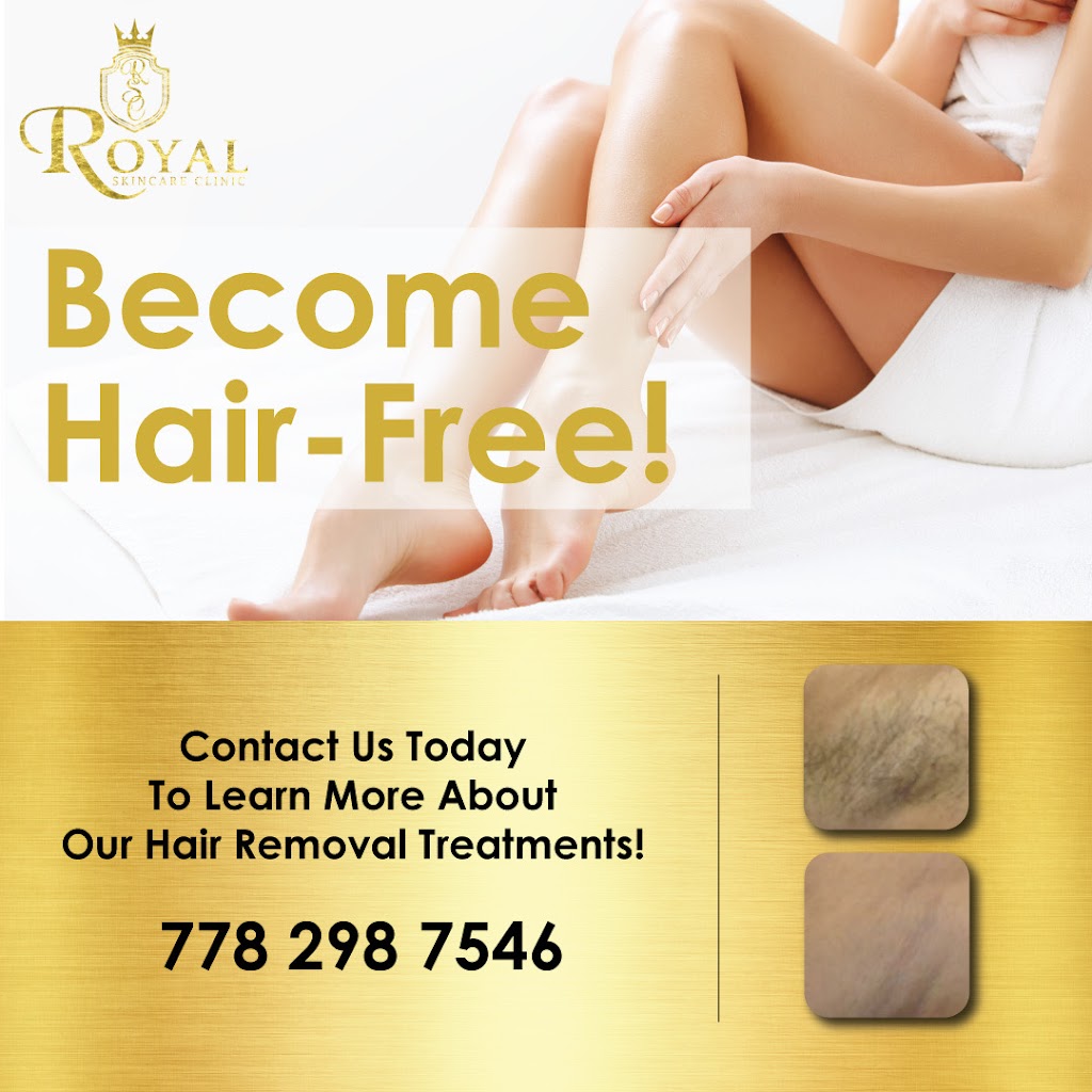 Royal Skincare Clinic | 19991 96 Ave, Langley, BC V1M 3C6, Canada | Phone: (778) 298-7546