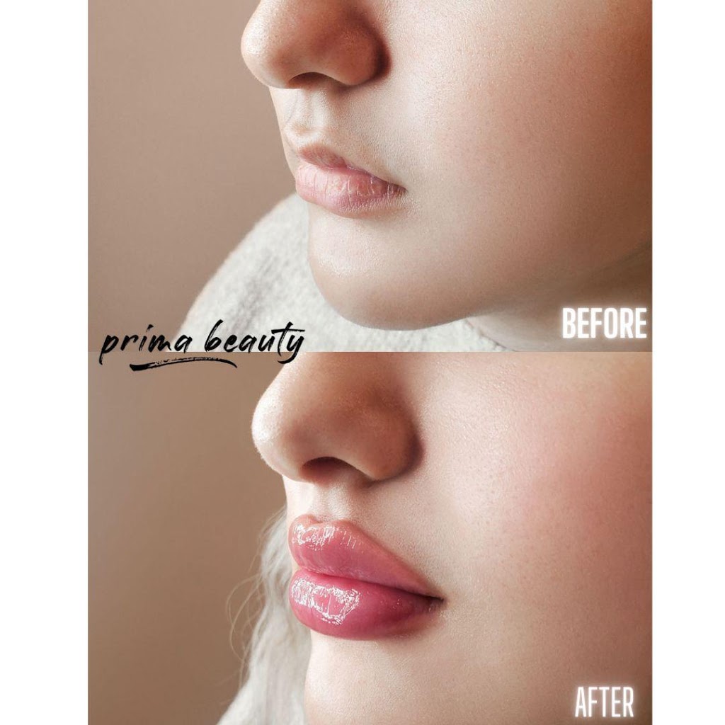 Prima Beauty Aesthetics | 4284 Owl Valley Dr, Gloucester, ON K1V 1L8, Canada | Phone: (613) 709-6477