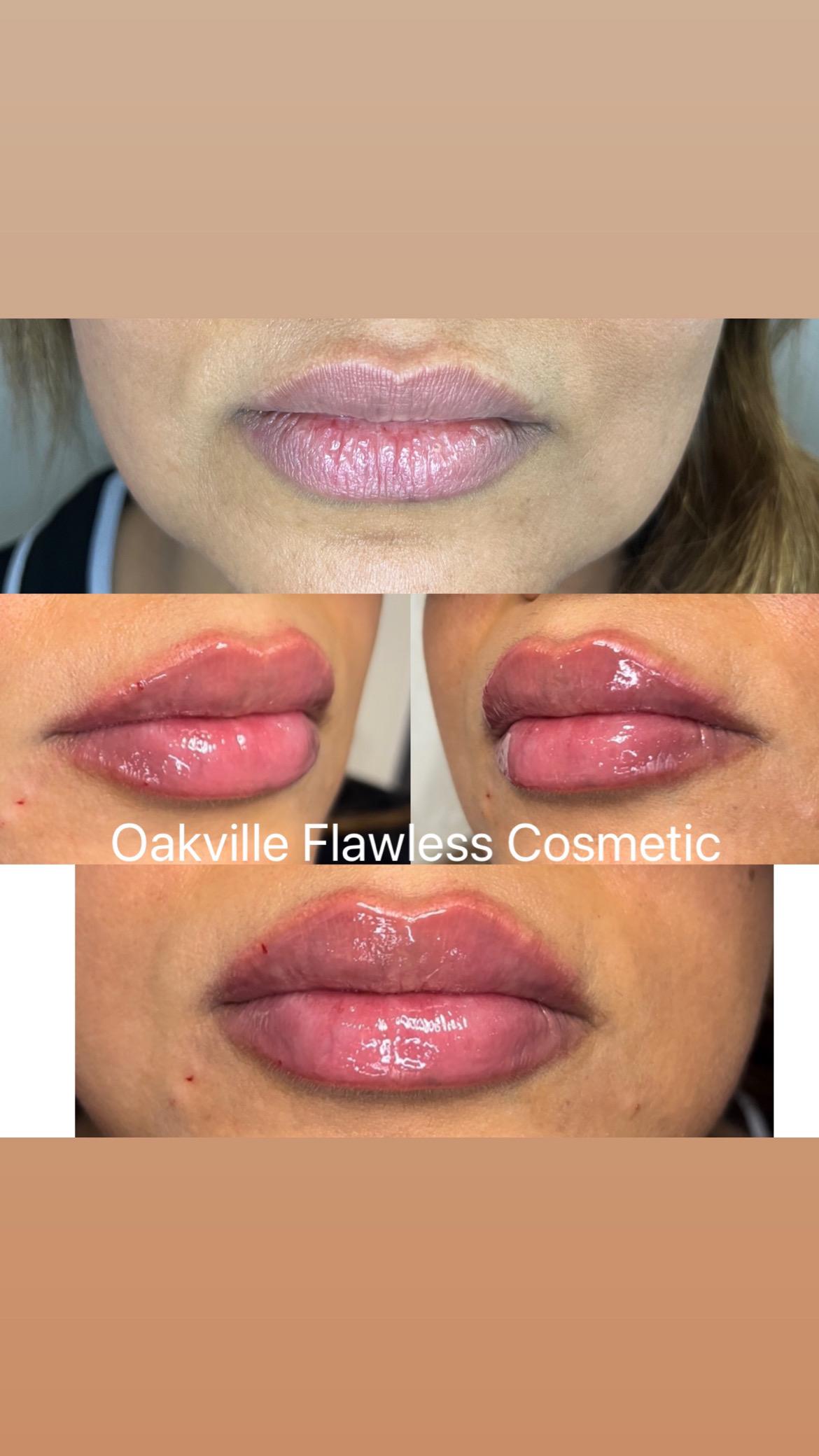 Oakville Flawless Cosmetic | 3075 Hospital Gate #109 First Floor Of North Oakville Medical Center, Oakville, ON L6M 1M1, Canada | Phone: (289) 885-5660