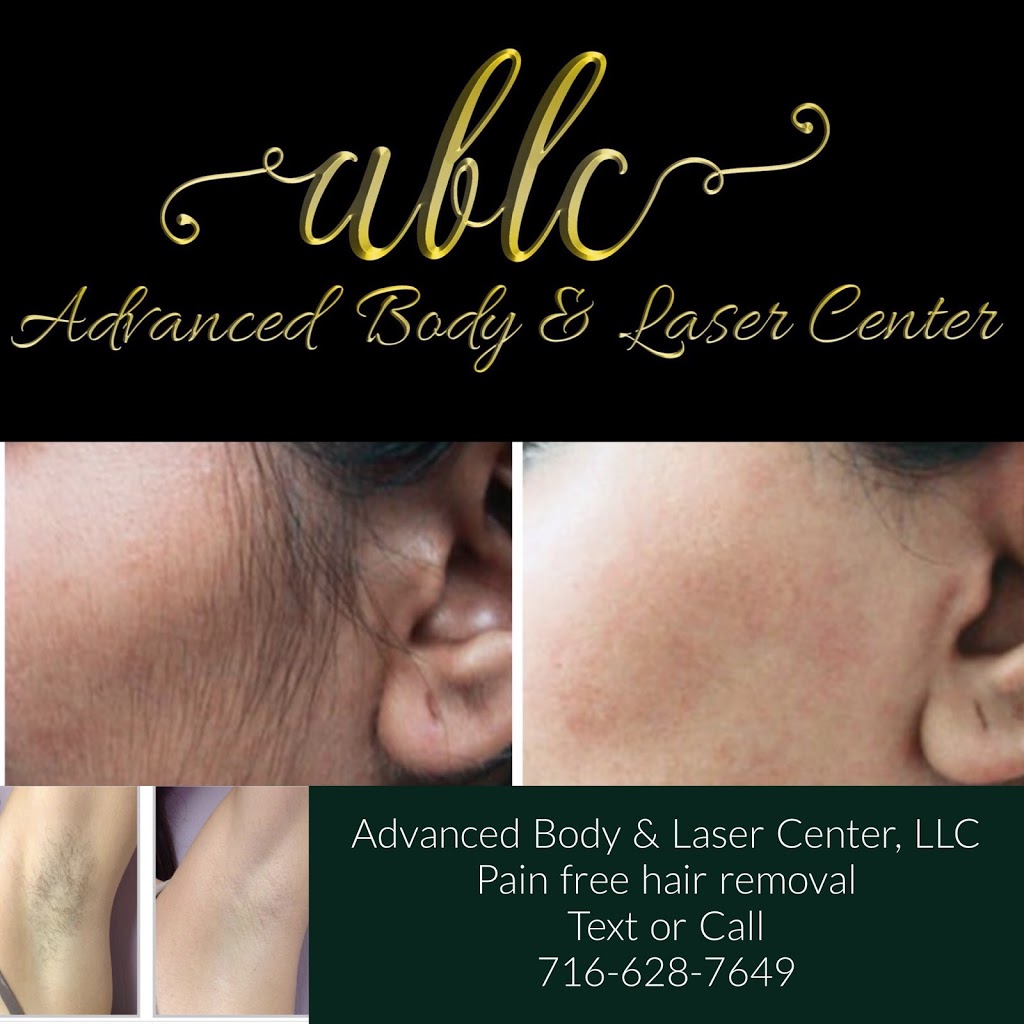 ABLC - Advanced Body & Laser Center | 165 Windham Ln, Grand Island, NY 14072, USA | Phone: (716) 628-7649