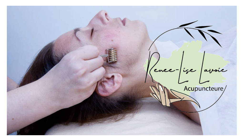 Acupuncture Renée-Lise Lavoie - Candiac | 70 Chem. Saint-François-Xavier, Candiac, QC J5R 4Z5, Canada | Phone: (450) 632-5777