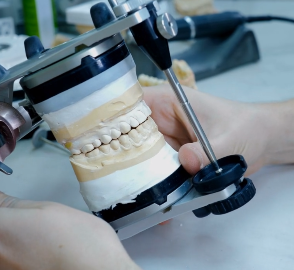 Modern Dental Technology Laboratory | 1295 Leila Ave, Winnipeg, MB R2P 2Z3, Canada | Phone: (204) 805-2589