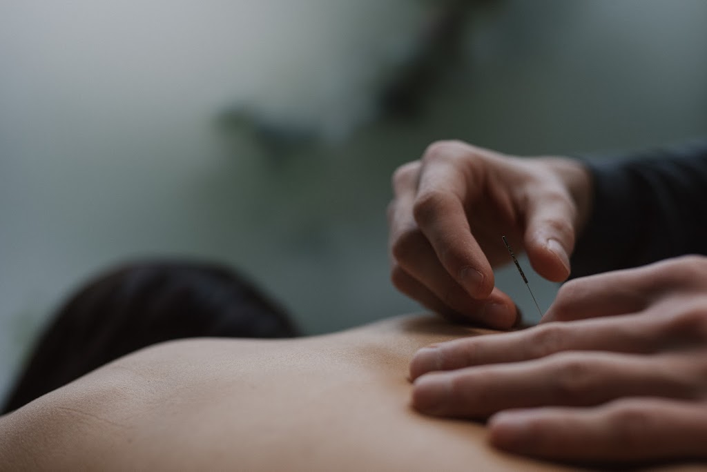 Acupuncture holistique - Christian Vyboh, acupuncteur | 222 Boul Henri-Bourassa E #30-1, Montréal, QC H3L 1B9, Canada | Phone: (514) 436-0405