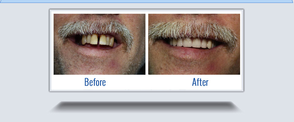 Waterdown Denture and Implant Clinic | 245 Dundas St E #3, Waterdown, ON L8B 0E9, Canada | Phone: (905) 690-0222