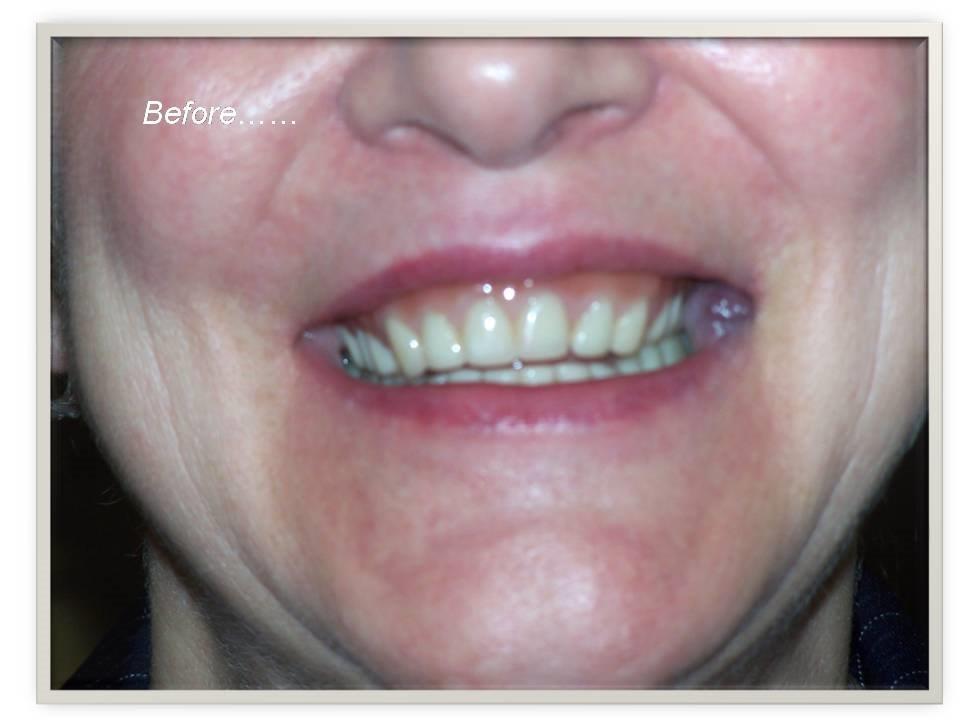 Central Park Denture Clinic | 1711 Cook St, Victoria, BC V8T 3P2, Canada | Phone: (250) 388-4100