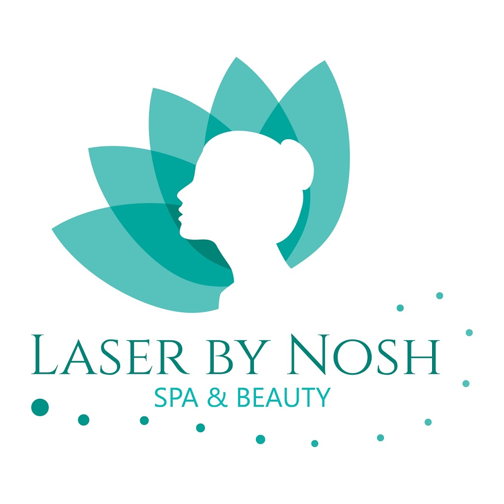 Laser By Nosh | 464 Sophia Cres, London, ON N6G 0T5, Canada | Phone: (647) 545-7947