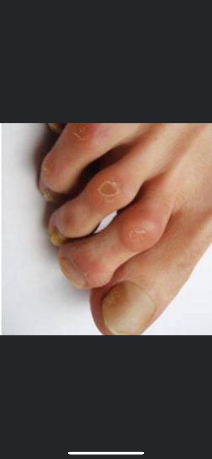 Clinique de soins de pieds/soins infirmiers Beauport | 202 Avenue St Michel, Québec, QC G1C 1G1, Canada | Phone: (418) 265-9447