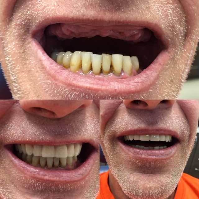 Great Smile Denture Clinic Inc | 566 Sheppard Ave W, North York, ON M3H 2R9, Canada | Phone: (416) 398-7846