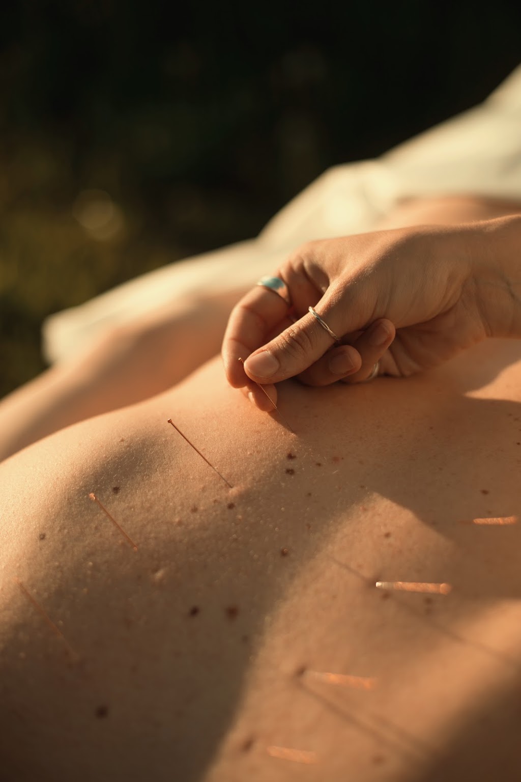 Célina Bédard Acupuncture | 578 QC-138, Neuville, QC G0A 2R0, Canada | Phone: (418) 655-9921