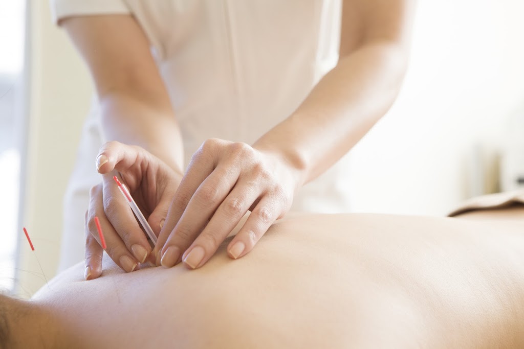 Health Healing Acupuncture | 9461 Jane St #103, Maple, ON L6A 4H8, Canada | Phone: (647) 821-2555