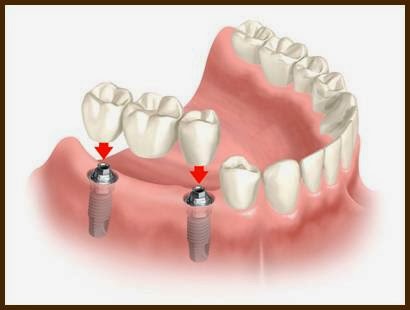 Westside Denture Centre | 1919 Sirocco Dr SW, Calgary, AB T3H 2Y3, Canada | Phone: (403) 242-5880