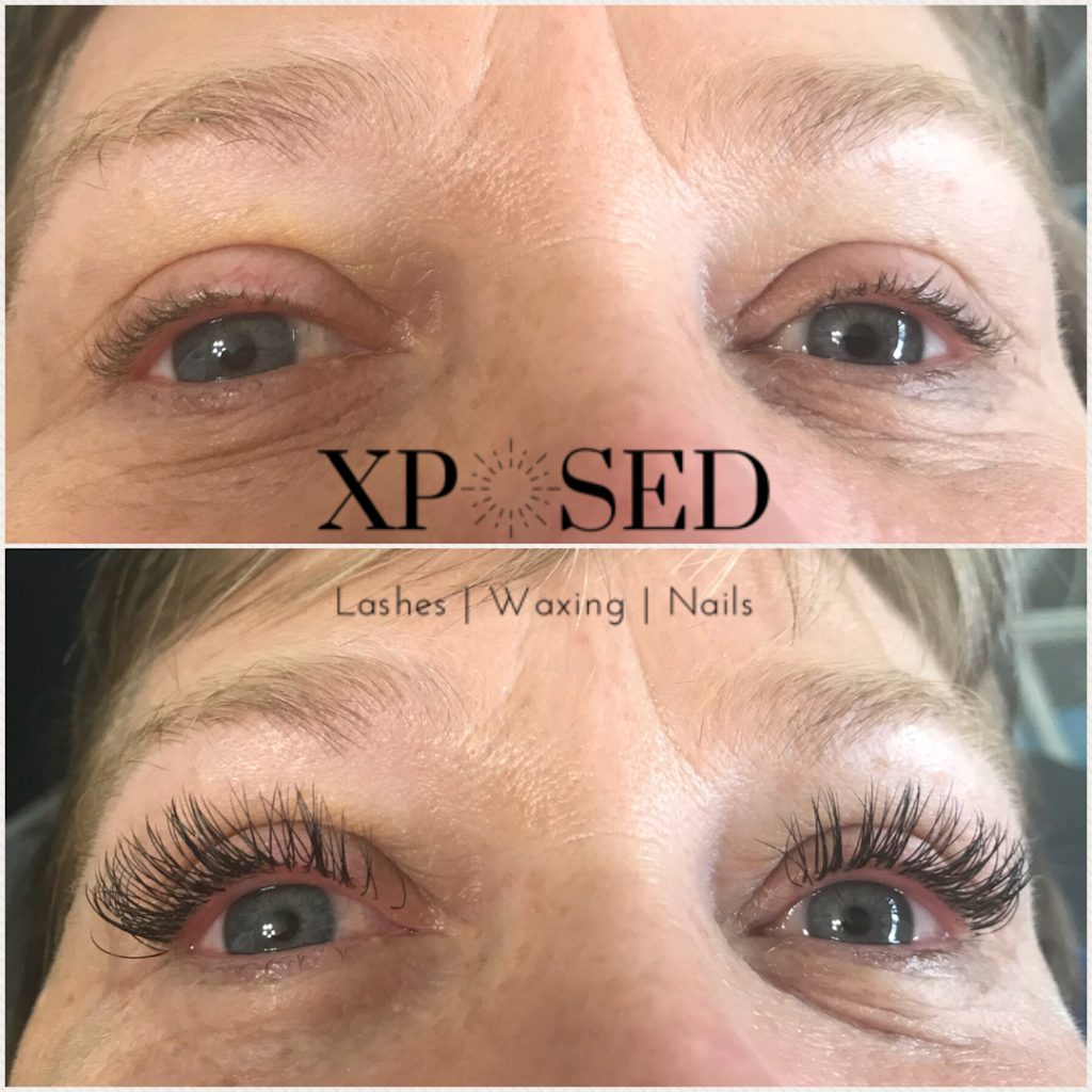 Xposed Esthetics | 529 Baycroft Dr, Martensville, SK S0K 2T2, Canada | Phone: (306) 203-4643