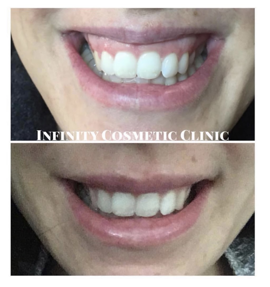 Infinity Cosmetic Clinic | 180 Pinebush Rd, Cambridge, ON N1R 7H8, Canada | Phone: (519) 740-7555