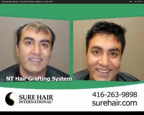 Sure Hair International | 5160 Explorer Dr Unit #10, Mississauga, ON L4W 4T7, Canada | Phone: (905) 890-6950