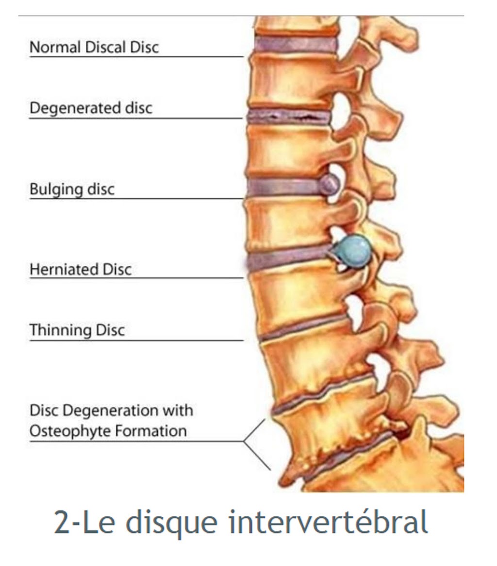 Physiotherapie Maisonneuve | 6612 Rue Beaubien E, Montréal, QC H1M 3B3, Canada | Phone: (514) 352-4442