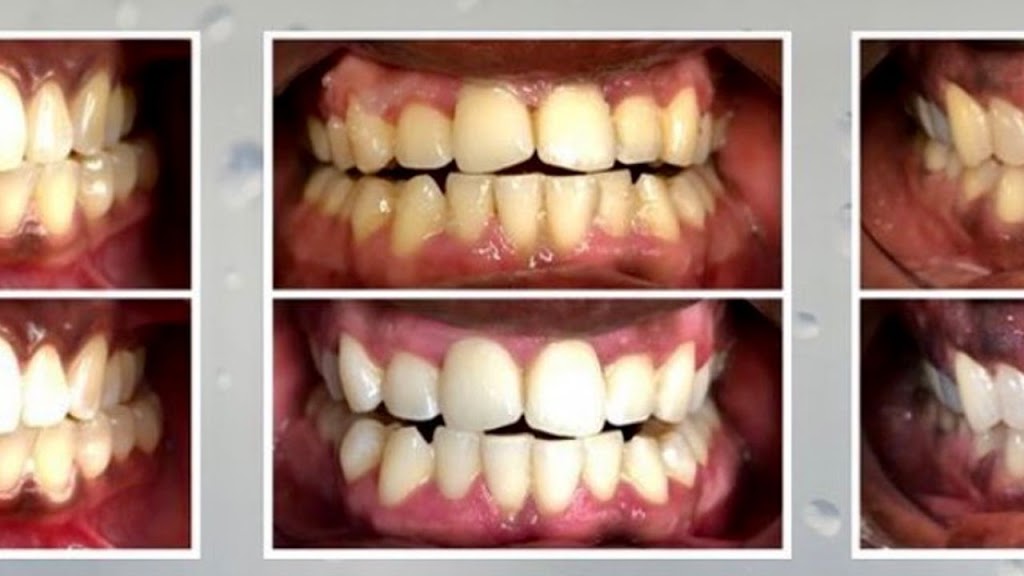 Luminescent Smile | 10 Brian Ave, Scarborough, ON M1R 3H9, Canada | Phone: (416) 804-4133