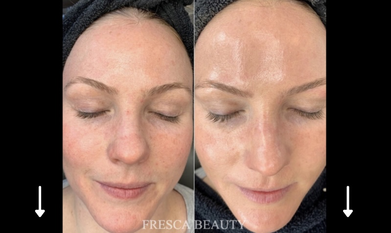 Fresca Beauty | 1949 Weston Rd, Toronto, ON M9N 1W8, Canada | Phone: (647) 696-6184